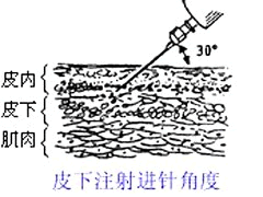 oX0uolsXP8.png