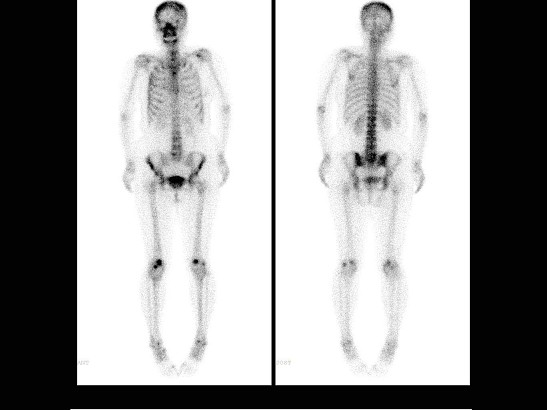 yX9agRAEPB.png yX9agRAEPB.png